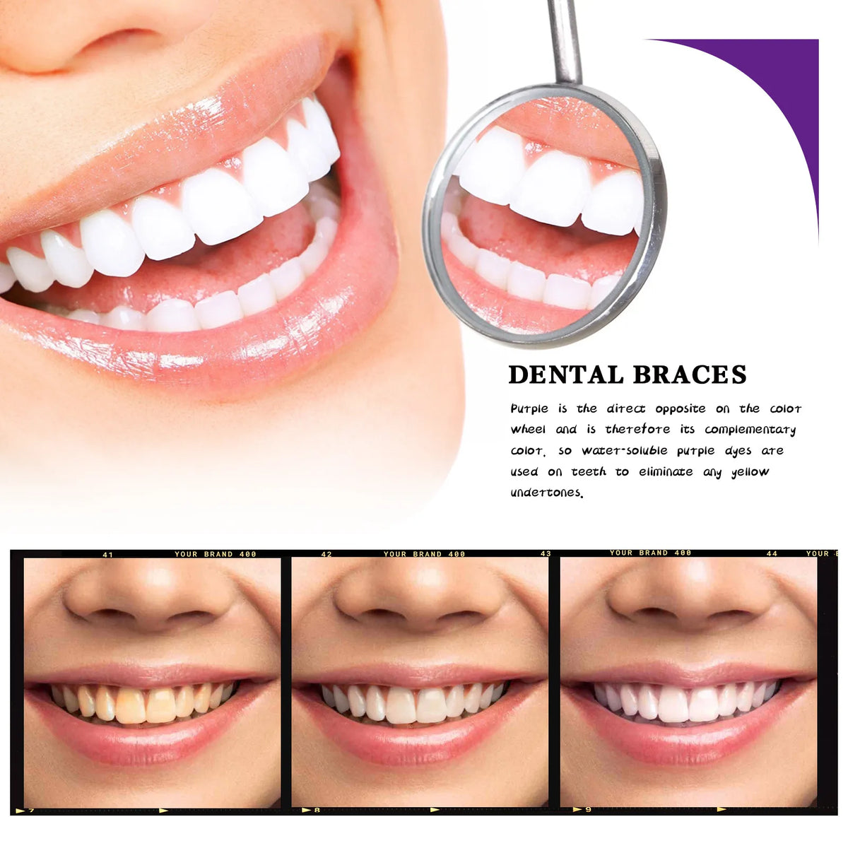 Collage of different people with various tooth colors and dental braces, with a focus on dental health and aesthetics.